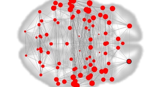 Can A ‘Fingerprint’ Of Your Brain Help Predict Disorders? | Smithsonian Magazine